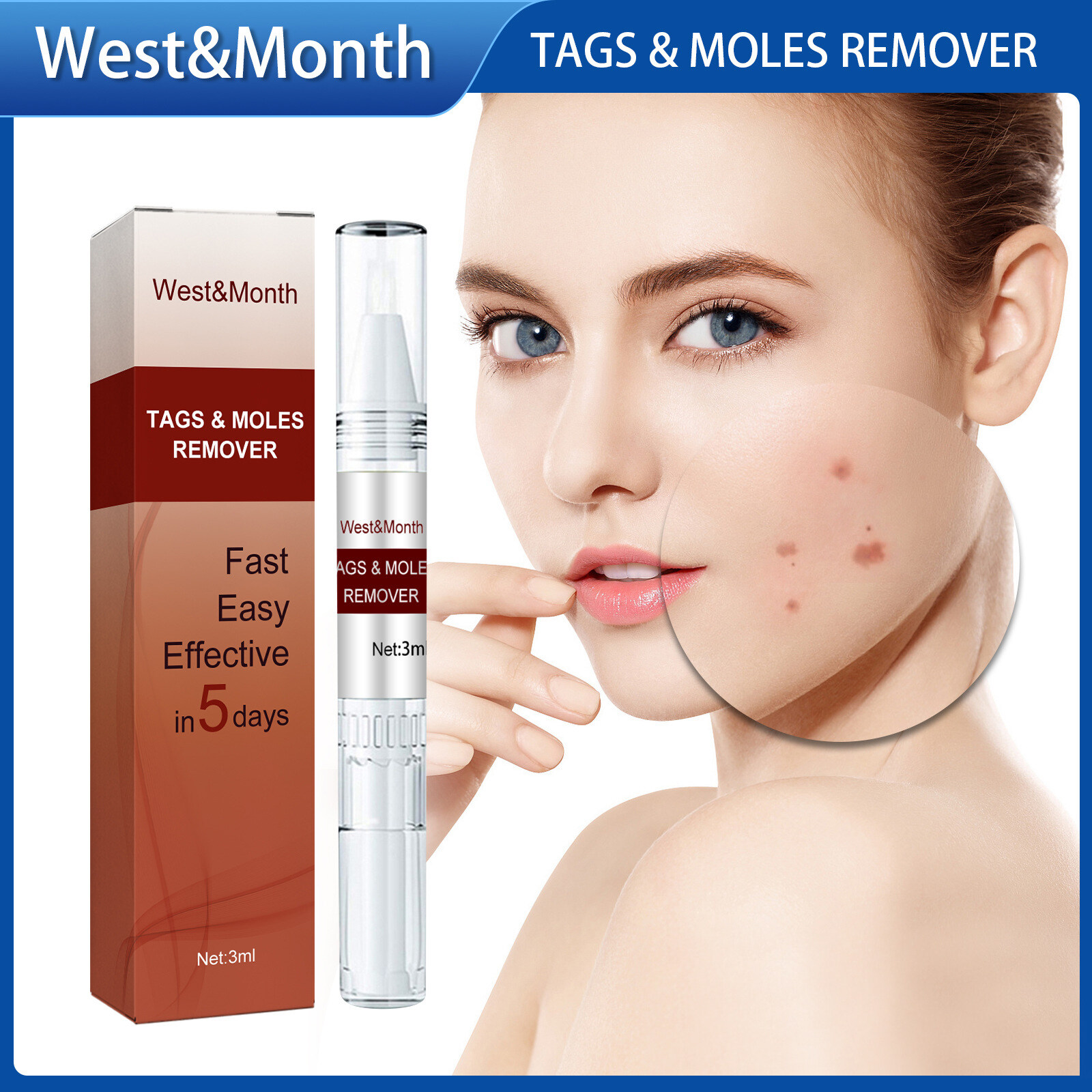 West Month Tags Moles Remover Pen Mole Remover Tags Remover Warts 3ml