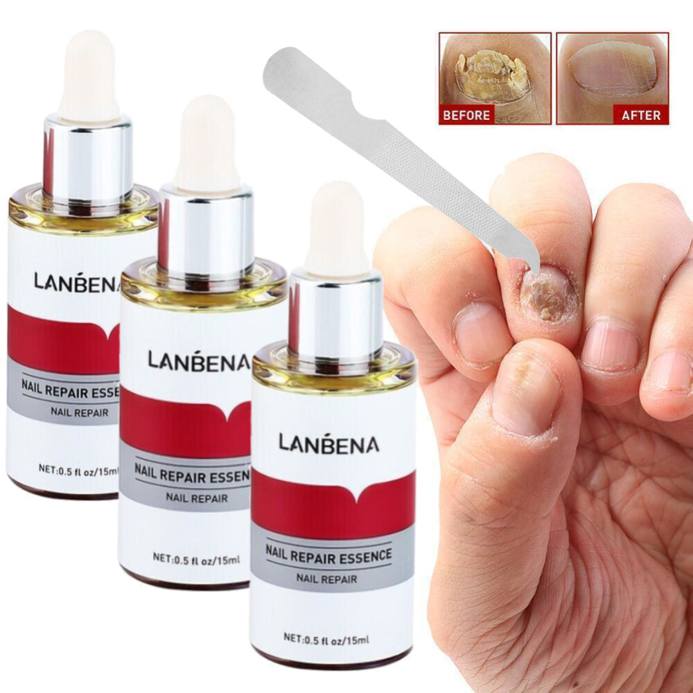 LANBENA Nail Repair Essence Serum Fungus Treatment Nail Removal Onychomycosis-15ml