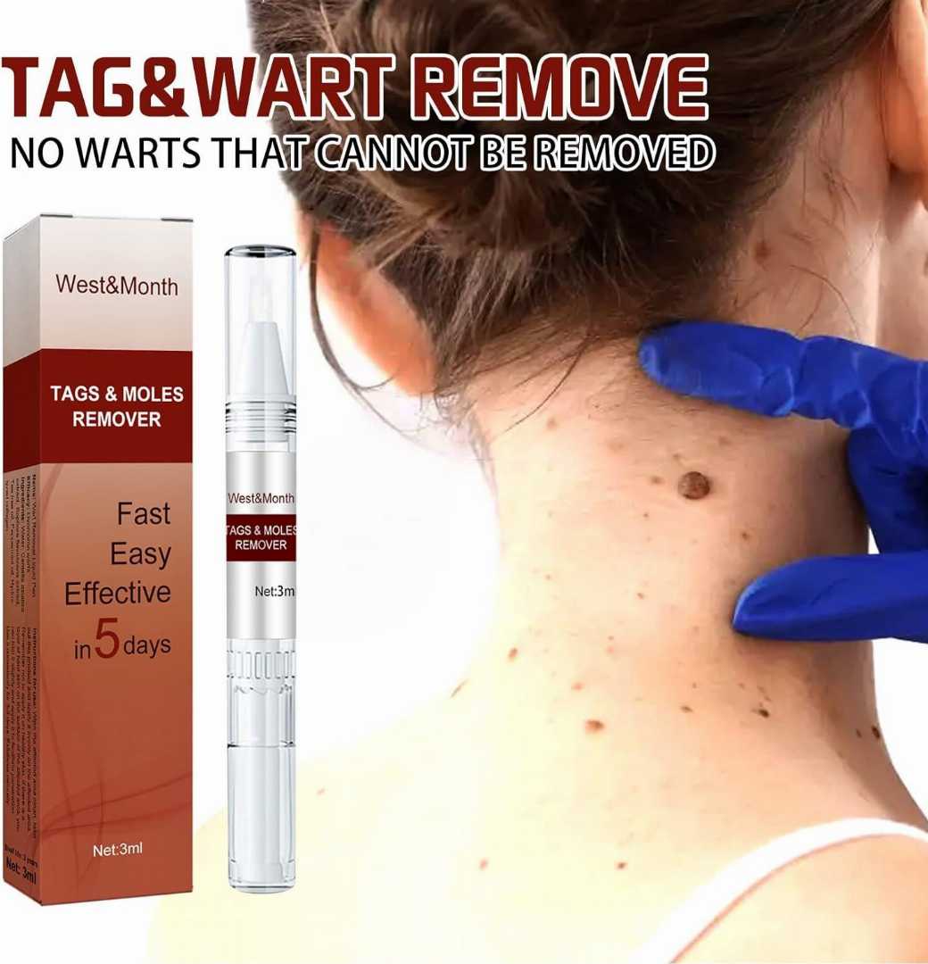 West Month Tags Moles Remover Pen Mole Remover Tags Remover Warts 3ml