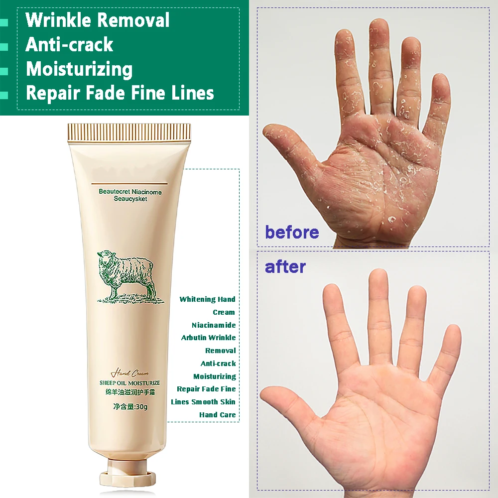 【Customizable】 Niacinamide Arbutin Hand Cream Whitening Wrinkle Removal Anti-crack Moisturizing Fade Fine Lines Korea Skin Care Health Beauty