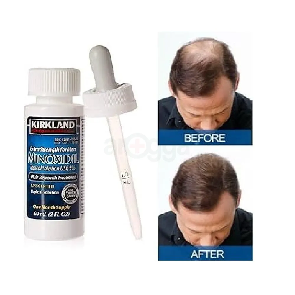 Kirkland Signature Topical Minoxidil 5% Extra Strength for Men Hair Regrowth Treatment with Derma Roller - 1 Month Supply - MNXMC
